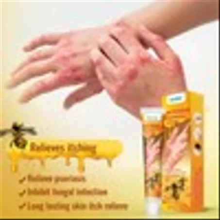 كريم سم النحل