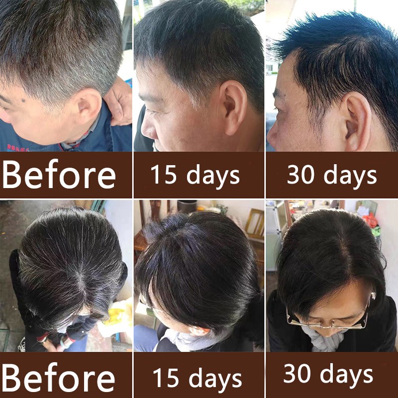 Black Hair Shampoo - UAE