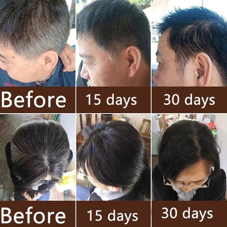 Black Hair Shampoo - UAE