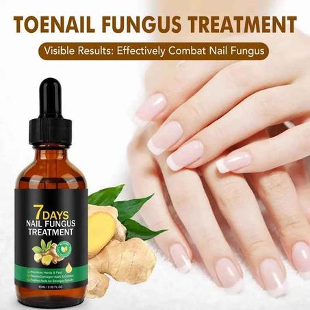 علاج فطريات الأظافر خلال 7 أيام