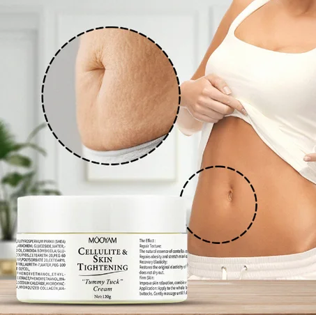 Scar Removal Cream Tummy Tuck  120g