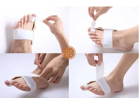 آداة لتصحيح وضعية أصبع القدم بدون تدخل جراحي Fromfoot Hallux Valgus Schiene