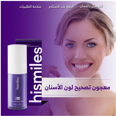 معجون تصحيح لون الأسنان