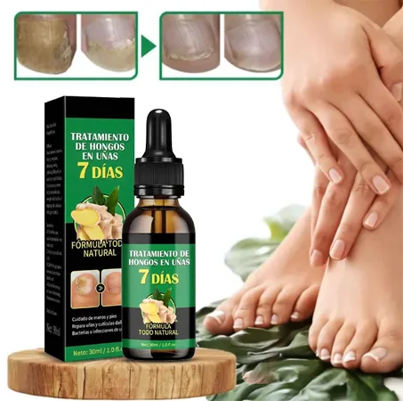 Sérum Reparador Intensivo: Adiós a los hongos y uñas quebradizas