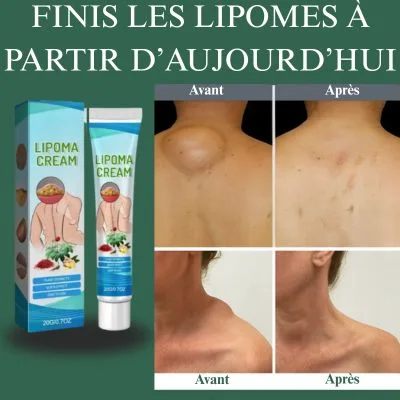🌿💧Éliminez vos lipomes naturellement chez vous avec cette crème efficace 🧴✅