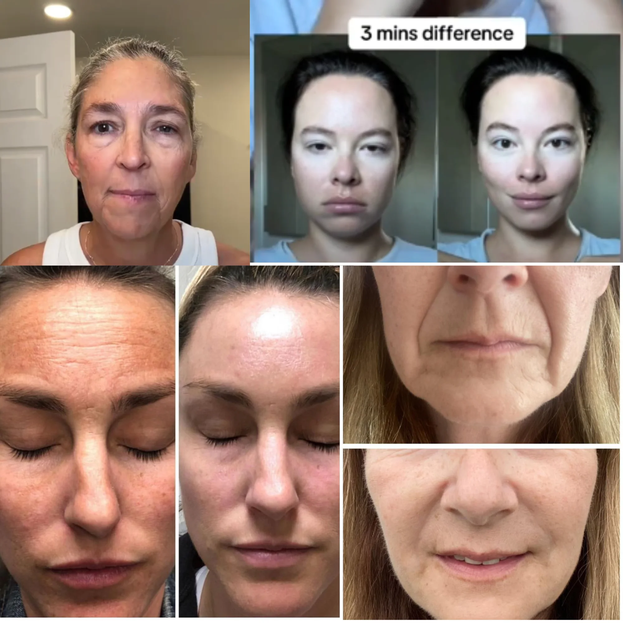 أداة شد و نحت الوجه   -  ORIGINAL face lifting Tool