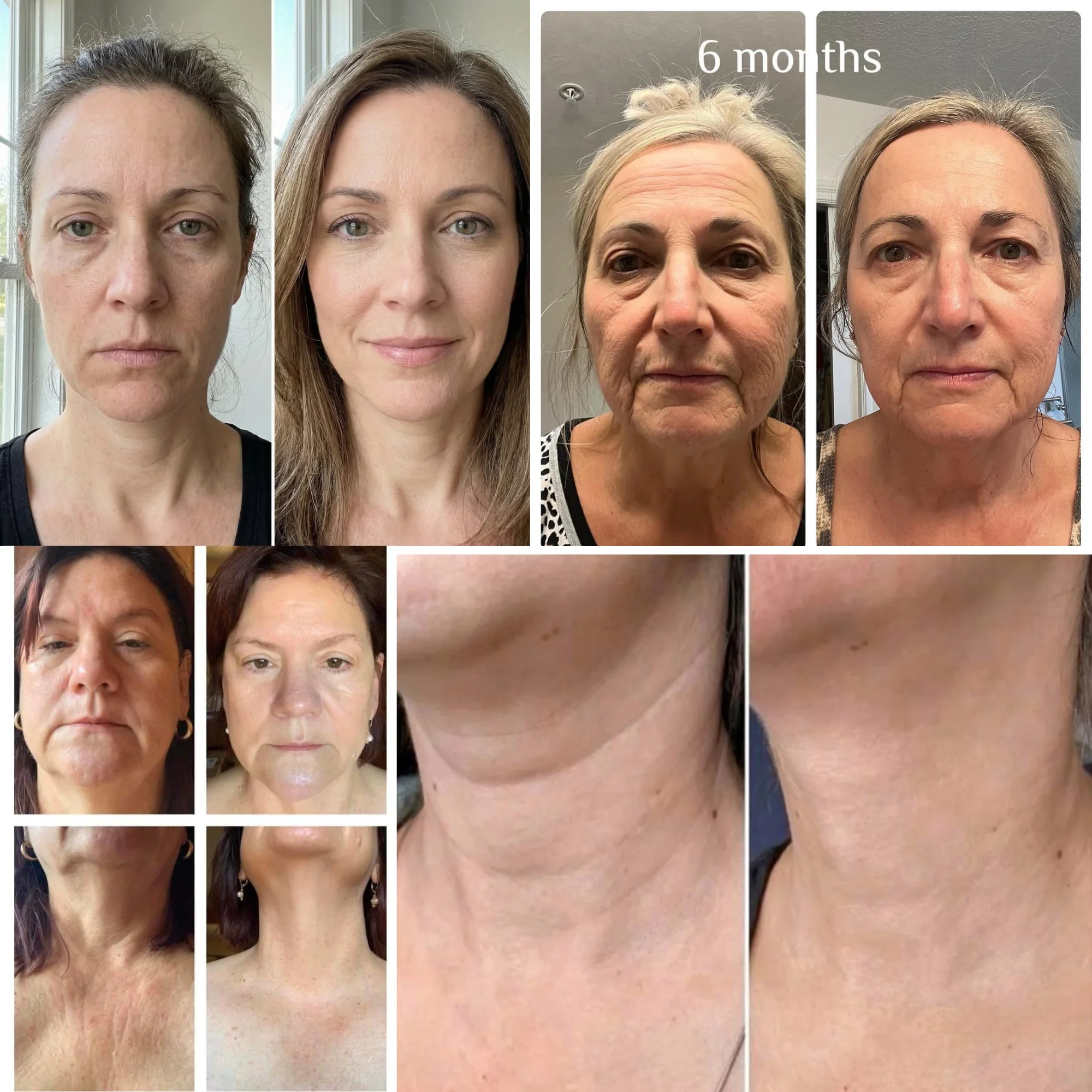 أداة شد و نحت الوجه   -  ORIGINAL face lifting Tool