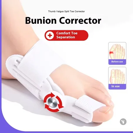 مصحح أصبع القدم الكبير ضابط الإبهام وعظام الاصبع