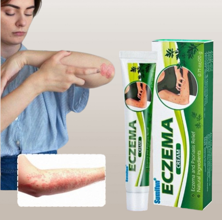 كريم الاكزيما والصدفية