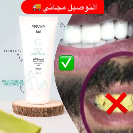 جال مبيض الاسنان  gel dentaire