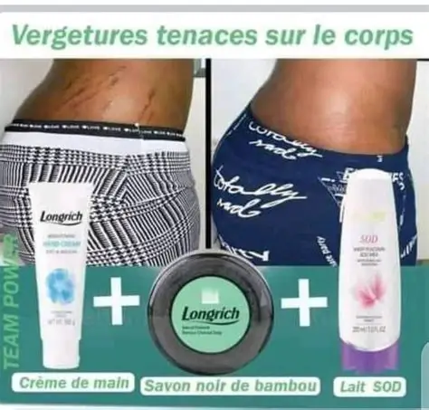Kit Vergeture