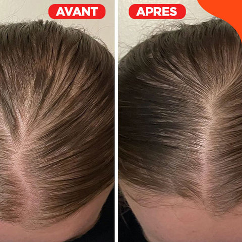 Brosse for massage 3 in 1