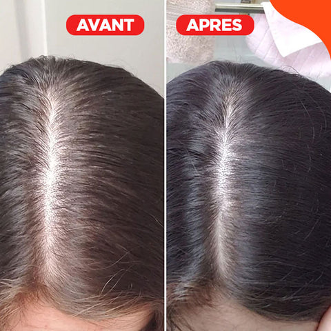 Brosse for massage 3 in 1