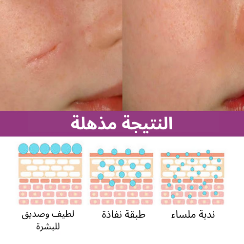 كريم إزالة الندوب