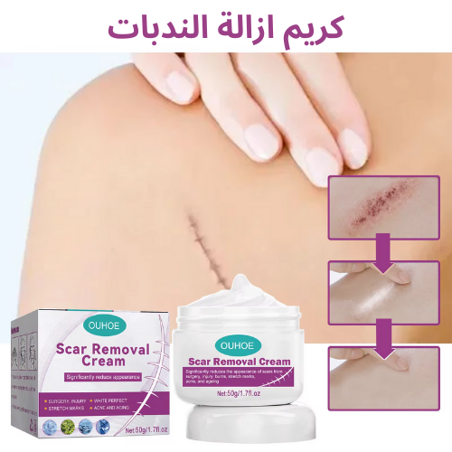 كريم إزالة الندوب