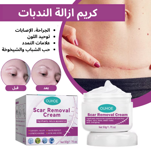 كريم إزالة الندوب