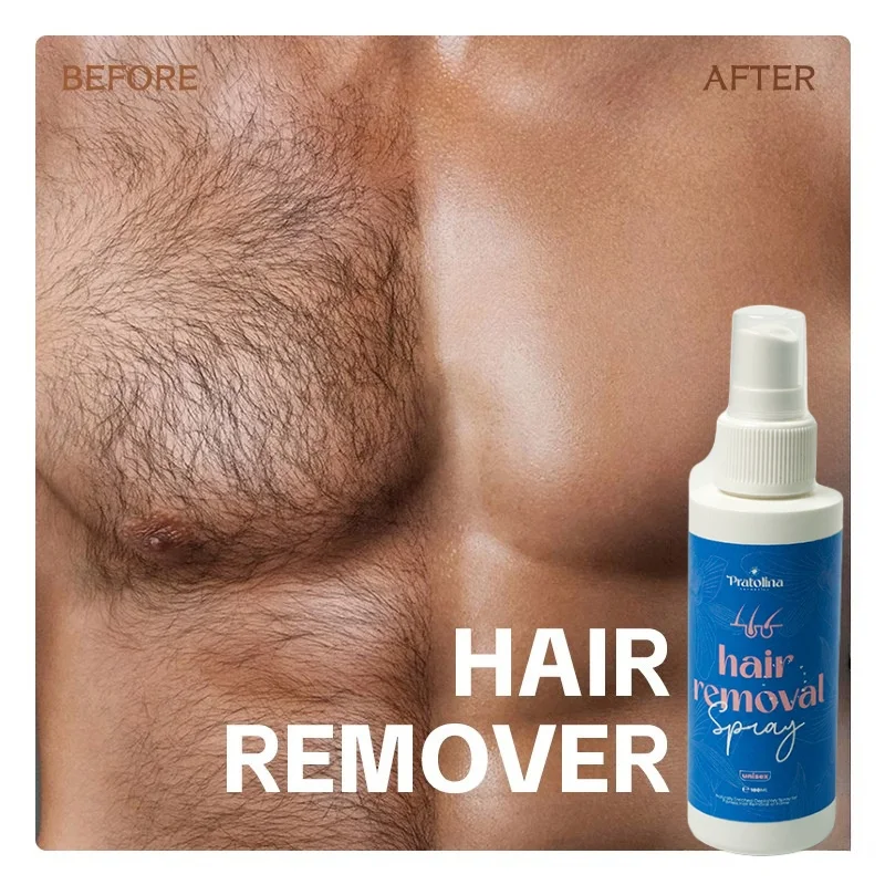 بخاخ ازالة الشعر