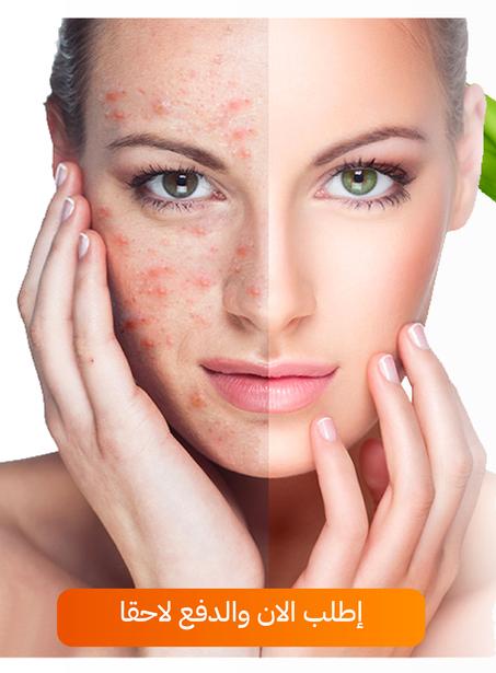 مصل علاج حب الشباب ACNE TREATMENT SERUM