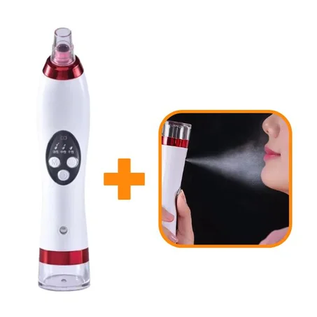 مزيل الرؤوس السوداء + بخاخ + توصيل مجاني