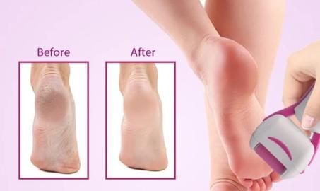 جهاز العناية بالقدمين kemei