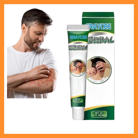 كريم  لعلاج الإكزيما