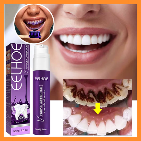 سيروم تبييض الأسنان