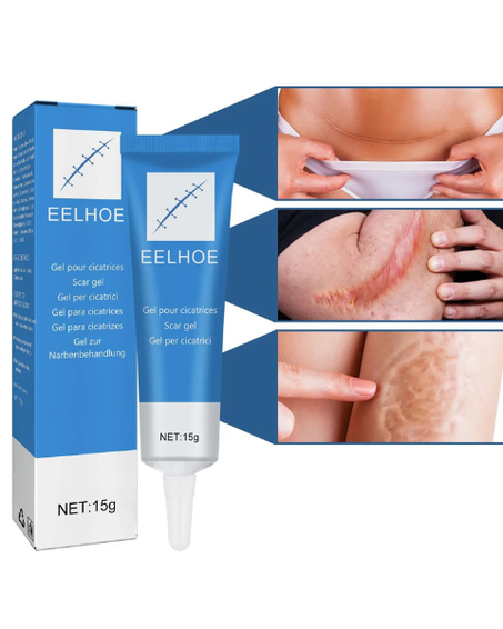 كريم ازالة آثار الندوب والحروق