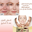 stores/099602ffacb97df6ee5a7f28c43e0bd1/products/TLbZCC3TPwzeaB79Ed9cyLZ0IpzogmXI658djkFD.png