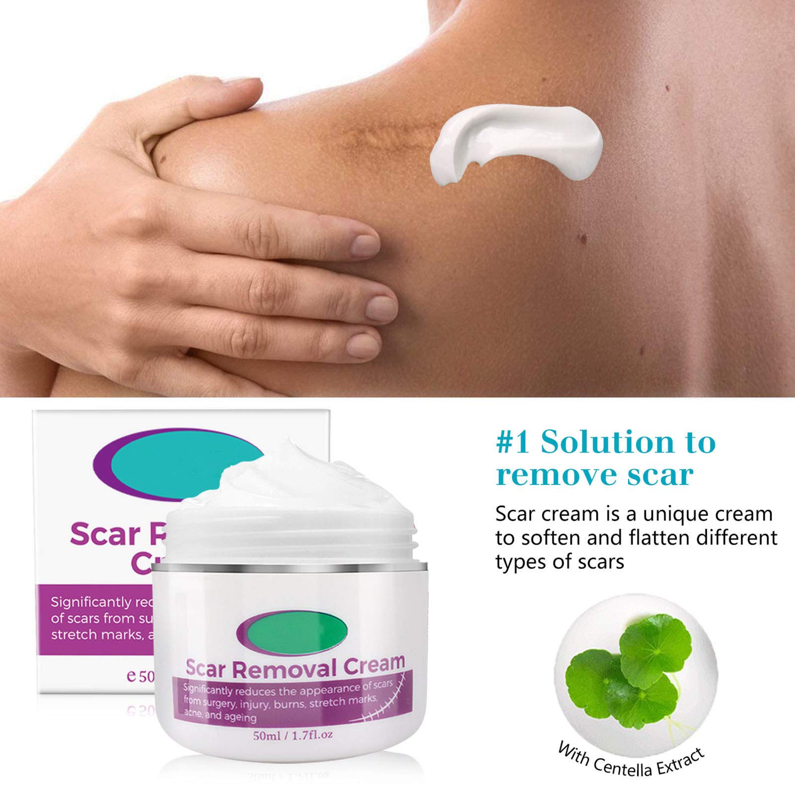 Magic scar removal cream