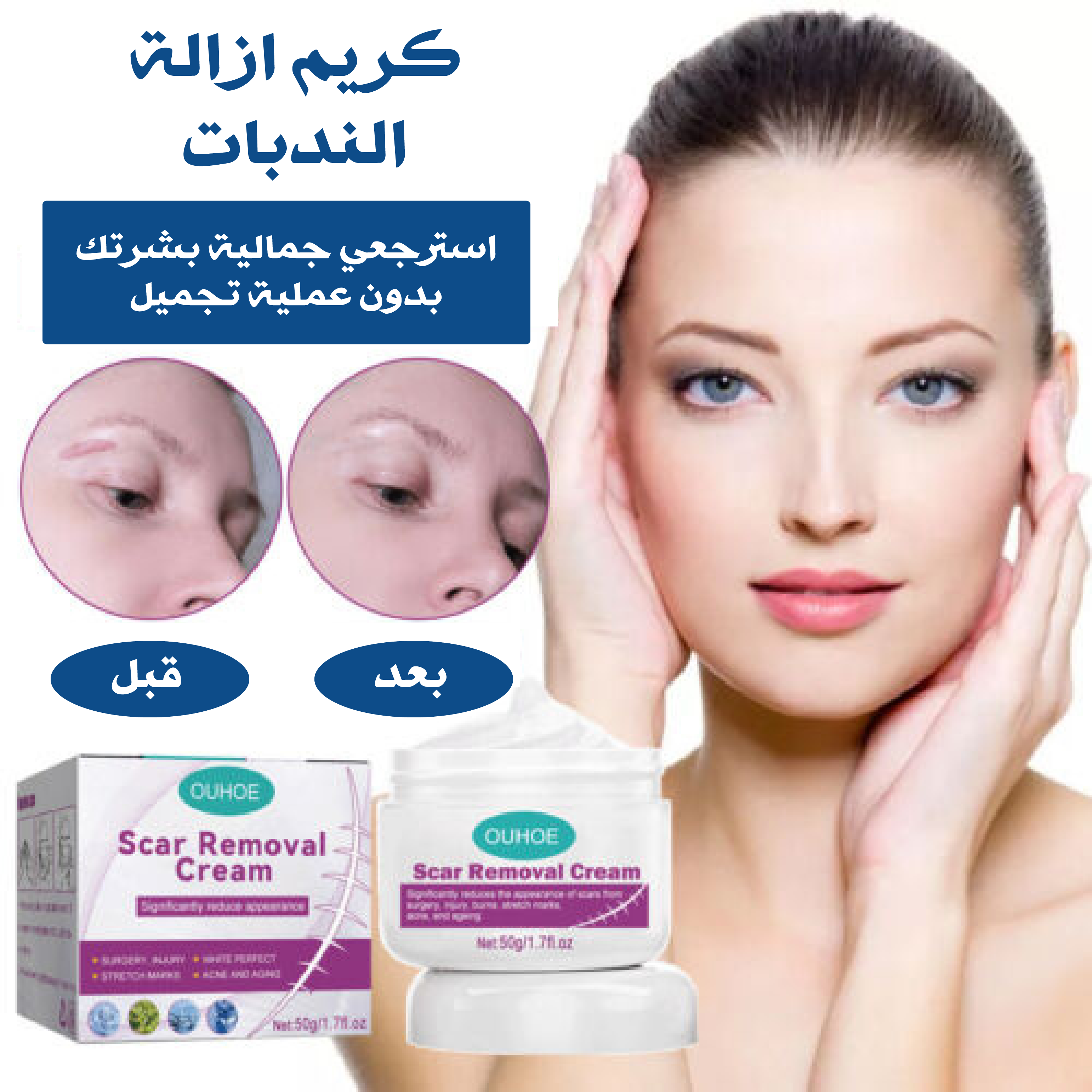Magic scar removal cream