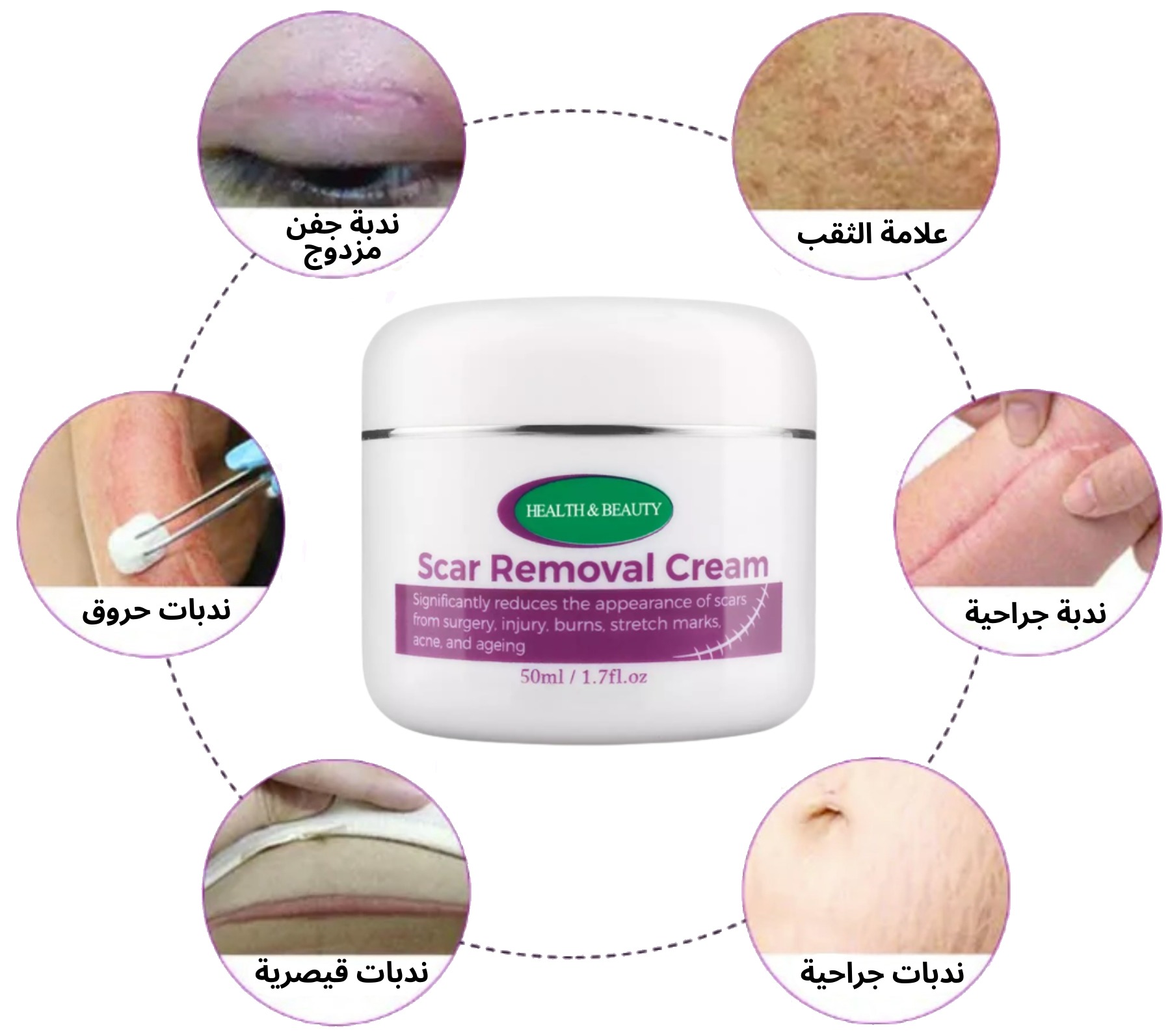 Magic scar removal cream