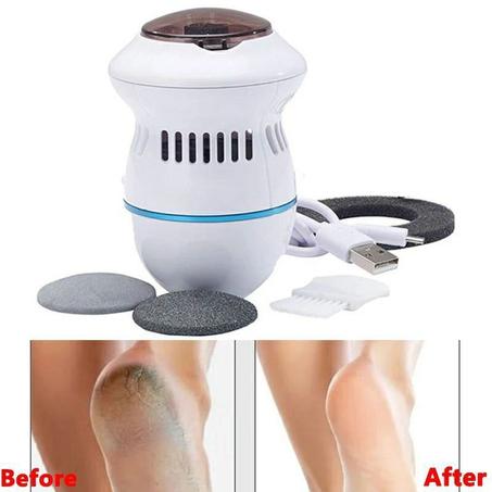 Dead skin remover for feet