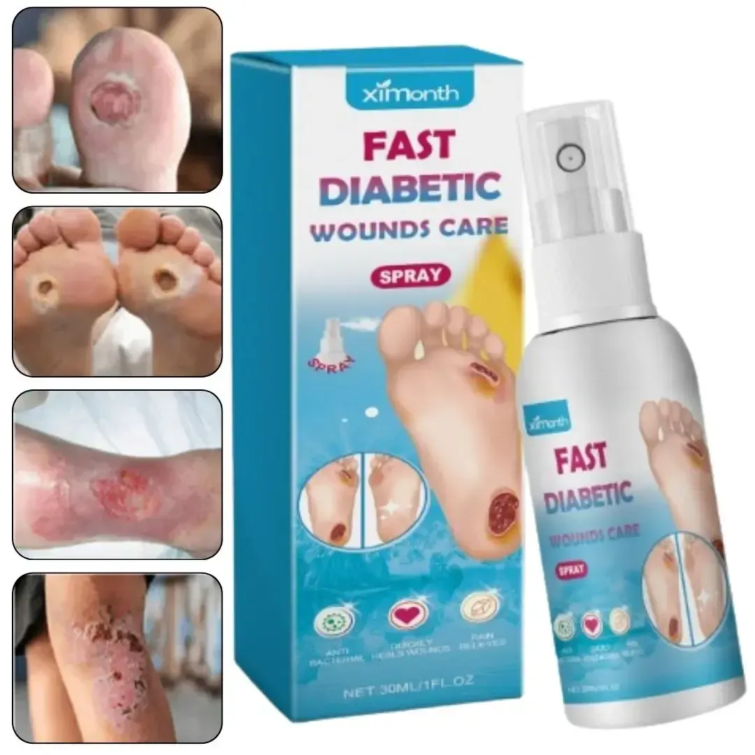 بخاخ Ximonth - لعلاج جروح مرضى السكري