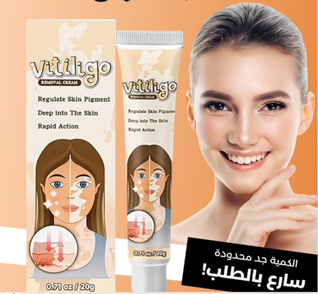 كريم مزيل البهاق
