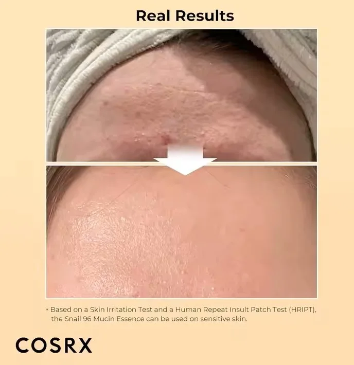 كوسركسAdvanced Snail 96 Mucin Power Essence