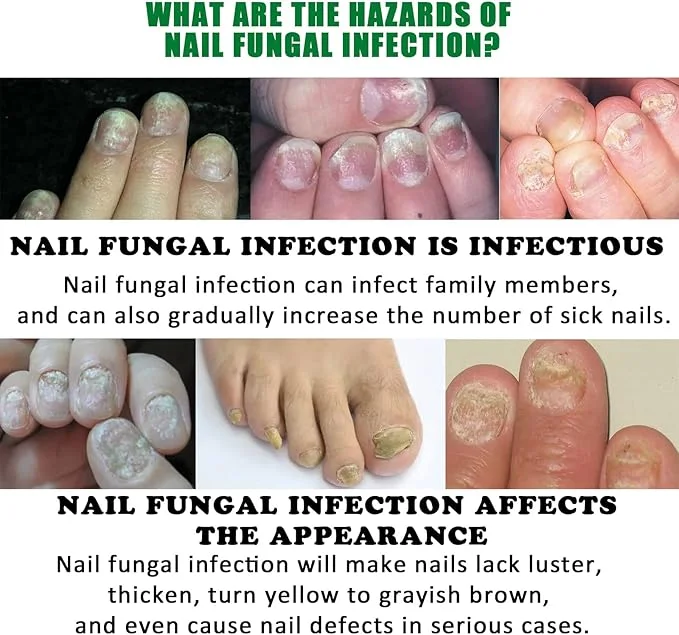 زيت الاهتمام بالارجل و اليدين