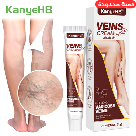 كريم تخفيف الدوالي