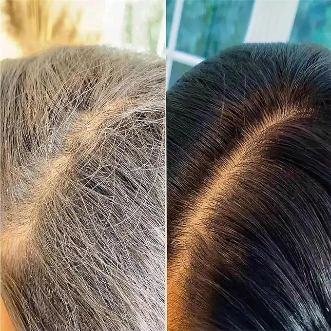 Miravie™ Hair Color Shampoo