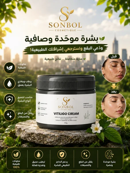 كريم العناية بالبشرة المتصبغة (البهاق)✅