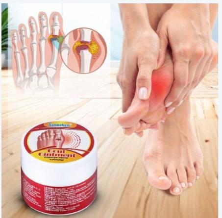 كريم لتخفيف آلام النقرس