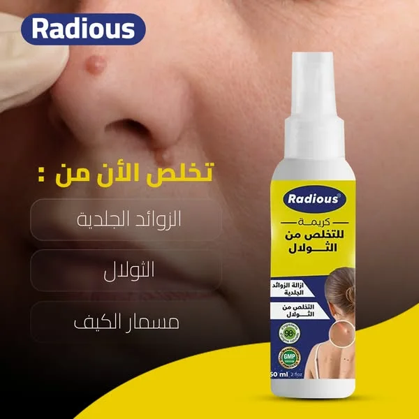 RADIOUS تخلص من الثولال بسهولة و فعالية