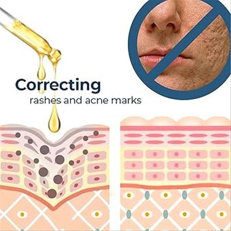 سيروم الكركم المضاد للأكسدة