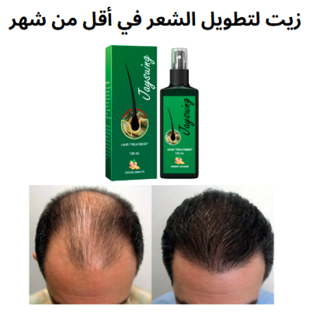 زيت نمو الشعر