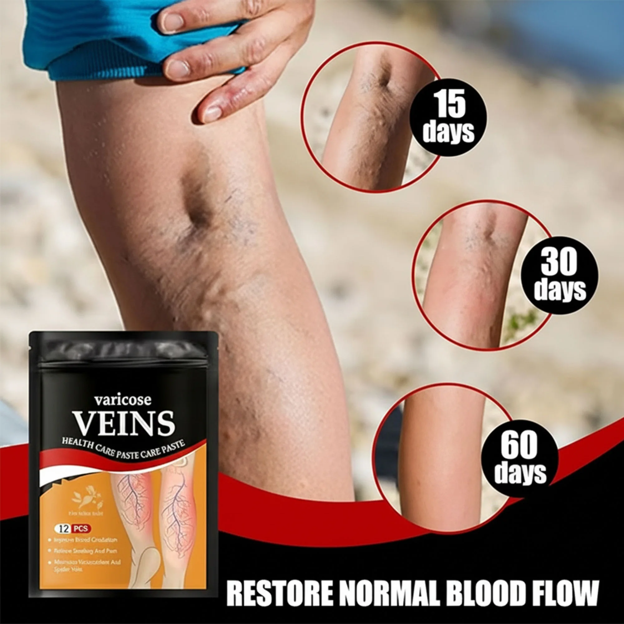 رقعة وريدية عشبية لتنشيط الدم وإزالة الدوالي