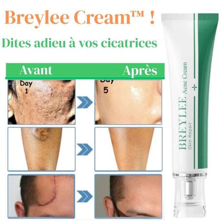 Cream™ anti-vergetures et anti-cicatrice