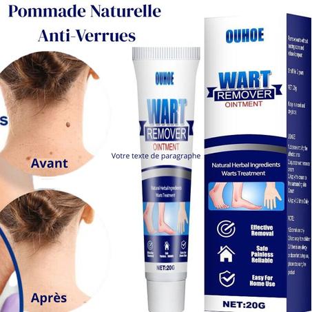 🧴 OUHOE Wart Remover – Pommade Naturelle Anti-Verrues (20g)