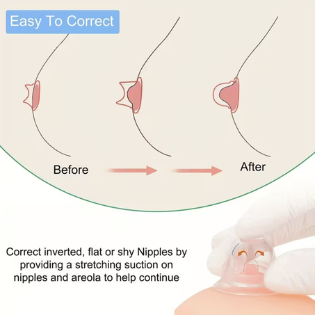 مُصحِّح الحلمات