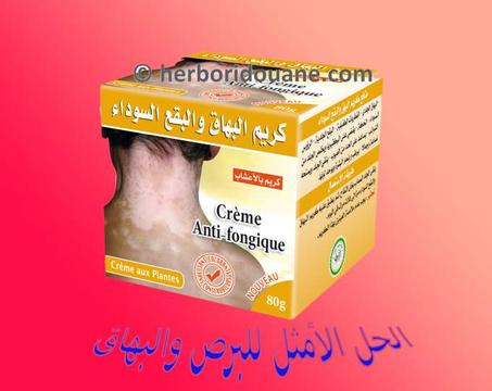 كريم البهاق و البقع السوداء