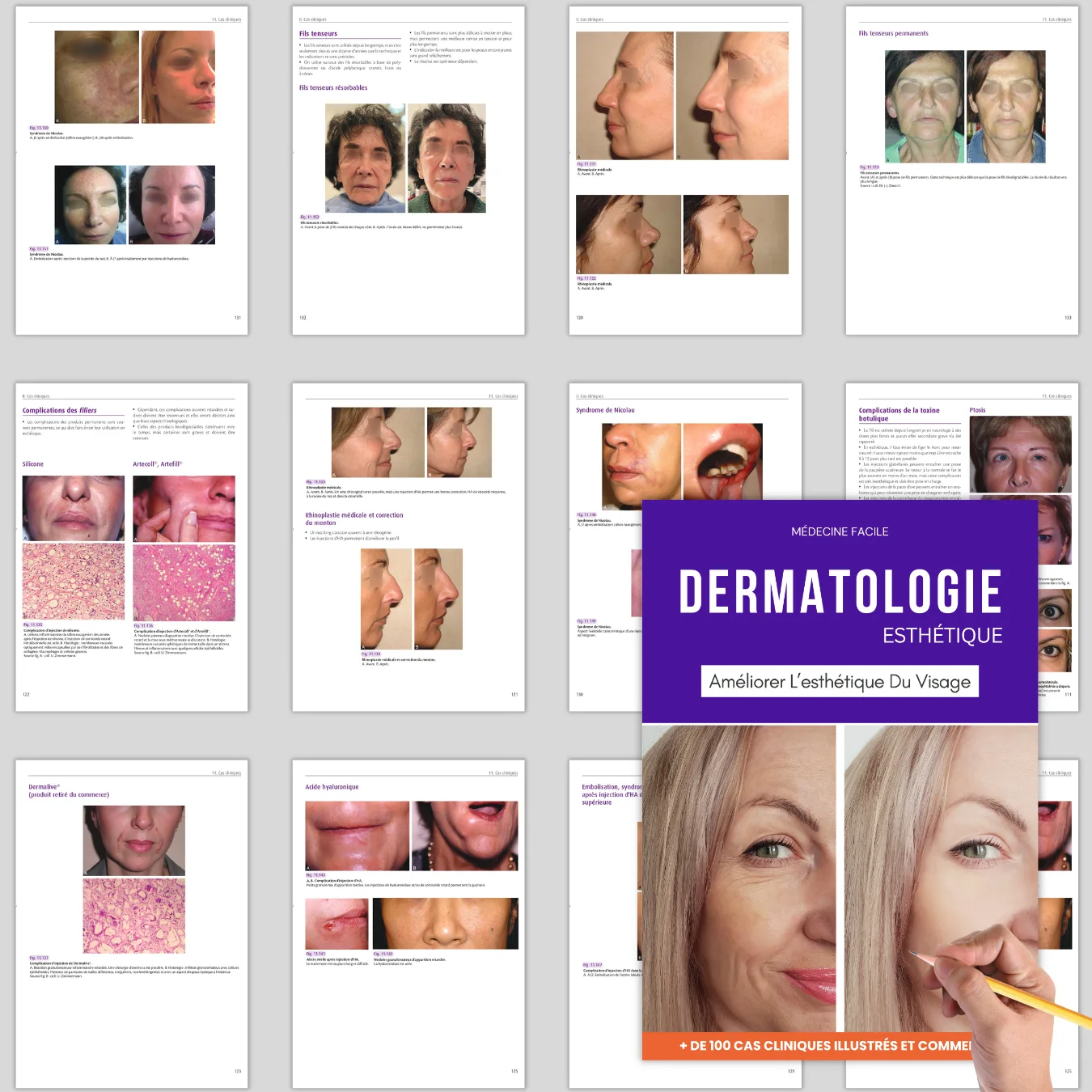 MÉGA-PACK MÉDECINE ESTHÉTIQUE — 3 GUIDES PDF PROFESSIONNELS