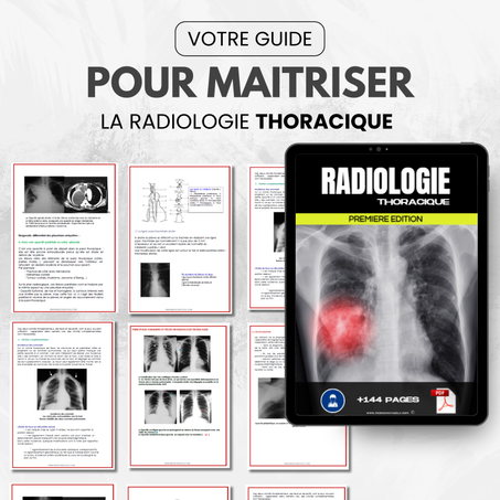 Votre Guide Essentiel Pour Maitriser La Radiologie Thoracique